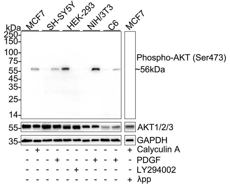 Western blot analysis on different lysates with NBP3-32747 at 1/2,000 dilution and pan AKT antibody at 1/2,000 dilution. Lane 1: MCF7 cell lysate Lane 2: MCF7 treated with 50ng/mL Calyculin A for 45 minutes cell lysate Lane 3: SH-SY5Y cell lysate Lane 4: SH-SY5Y treated with 100ng/mL PDGF for 5 minutes cell lysate Lane 5: HEK-293 cell lysate Lane 6: HEK-293 treated with 50μM LY294002 for 6 hours cell lysate Lane 7: NIH/3T3 cell lysate Lane 8: NIH/3T3 treated with 100ng/mL PDGF for 5 minutes cell lysate Lane 9: C6 cell lysate Lane 10: C6 treated with 100ng/mL PDGF for 5 minutes cell lysate Lane 11: MCF7 treated with 50ng/mL Calyculin A for 45 minutes cell lysate, then the membrane treated with  lambda pp for 1 hour Lysates/proteins at 20 µg/Lane. Predicted band size: 56 kDa Observed band size: 56 kDa Exposure time: 20 seconds;  4-20% SDS-PAGE gel. Proteins were transferred to a PVDF membrane and blocked with 5% BSA for 1 hour at room temperature. NBP3-32747 at 1/2,000 dilution and pan AKT antibody (HA721870) at 1/2,000 dilution were used in 5% BSA at 4℃ overnight. Goat Anti-Rabbit IgG [HRP] Secondary Antibody at 1/50,000 dilution was used for 1 hour at room temperature.