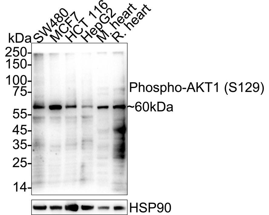 Western blot analysis on different lysates with NBP3-32748 at 1/1,000 dilution. Lane 1: SW480 cell lysate (20 µg/Lane) Lane 2: MCF7 cell lysate (20 µg/Lane) Lane 3: HCT 116 cell lysate (20 µg/Lane) Lane 4: HepG2 cell lysate (20 µg/Lane) Lane 5: Mouse heart tissue lysate (40 µg/Lane) Lane 6: Rat heart tissue lysate (40 µg/Lane) Predicted band size: 56 kDa Observed band size: 60 kDa Exposure time: 3 minutes;  4-20% SDS-PAGE gel. Proteins were transferred to a PVDF membrane and blocked with 5% NFDM/TBST for 1 hour at room temperature. NBP3-32748 at 1/1,000 dilution was used in primary antibody dilution at 4℃ overnight. Goat Anti-Rabbit IgG [HRP] Secondary Antibody at 1/50,000 dilution was used for 1 hour at room temperature.
