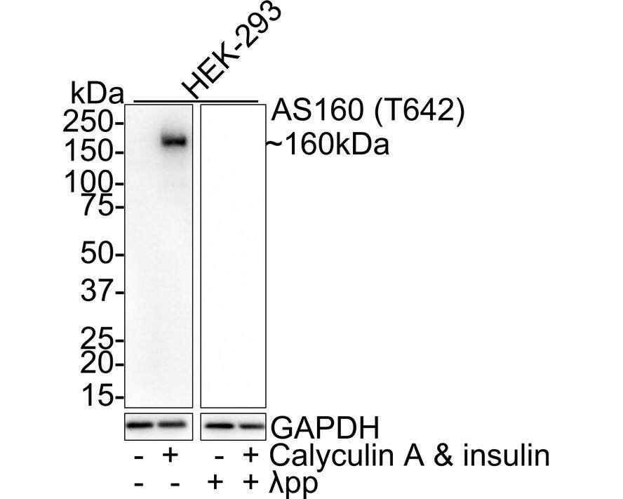 Western Blot TBC1D4 [p Thr642] Antibody (JE60-97)