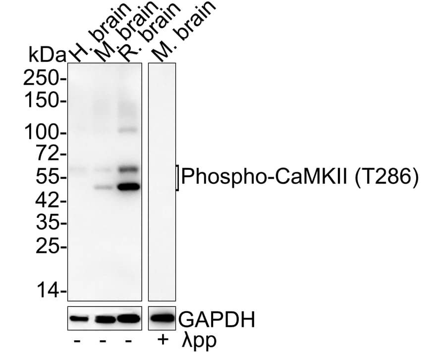 Western Blot: CaM Kinase II [p Thr286] Antibody (JE51-81) [NBP3-32752] - Western blot analysis of CaM Kinase II on different lysates with Rabbit anti-CaM Kinase II antibody (NBP3-32752) at 1/1,000 dilution. Lane 1: Human brain tissue lysate Lane 2: Mouse brain tissue lysate Lane 3: Rat brain tissue lysate Lane 4: Mouse brain treated with  pp for 1 hour tissue lysate Lysates/proteins at 30 ug/Lane. Predicted band size: 54~73 kDa Observed band size: 50~60 kDa Exposure time: 53 seconds; 4-20% SDS-PAGE gel. Proteins were transferred to a PVDF membrane and blocked with 5% NFDM/TBST for 1 hour at room temperature. The primary antibody (NBP3-32752) at 1/1,000 dilution was used in 5% NFDM/TBST at 4C overnight. Goat Anti-Rabbit IgG - HRP Secondary Antibody at 1/50,000 dilution was used for 1 hour at room temperature.