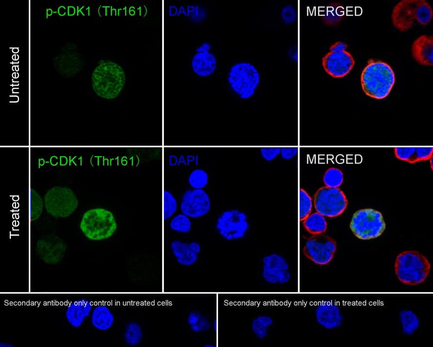 Immunocytochemistry/ Immunofluorescence: CDC2/CDK1 [p Thr161] Antibody (PSH03-42) [NBP3-32753] - Immunocytochemistry analysis of Jurkat cells treated with or without 100nM Calyculin A for 30 minutes labeling CDC2/CDK1 with Rabbit anti-CDC2/CDK1 antibody (NBP3-32753) at 1/2,500 dilution. Cells were fixed in 100% precooled methanol for 5 minutes at room temperature, then blocked with 1% BSA in 10% negative goat serum for 1 hour at room temperature. Cells were then incubated with Rabbit anti-CDC2/CDK1 antibody (NBP3-32753) at 1/2,500 dilution in 1% BSA in PBST overnight at 4 ℃. Goat Anti-Rabbit IgG H&L (iFluor™ 488) was used as the secondary antibody at 1/1,000 dilution. PBS instead of the primary antibody was used as the secondary antibody only control. Nuclear DNA was labelled in blue with DAPI. Beta tubulin (red) was stained at 1/100 dilution overnight at +4℃. Goat Anti-Mouse IgG H&L (iFluor™ 594) was used as the secondary antibody at 1/1,000 dilution.