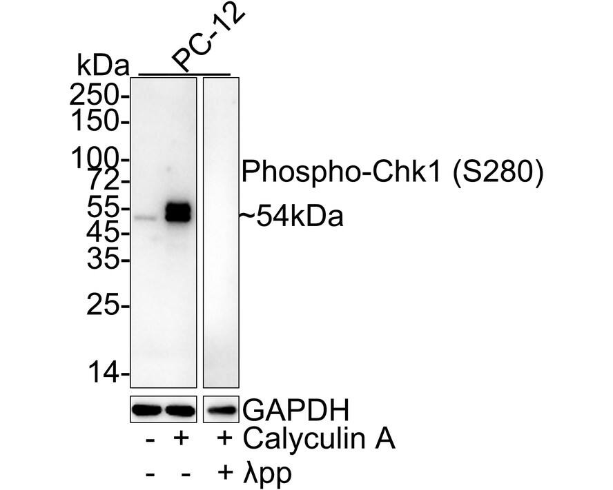 Western blot analysis on different lysates with NBP3-32754 at 1/1,000 dilution. Lane 1: PC-12 whole cell lysate Lane 2: PC-12 treated with 100nM Calyculin A for 30 minutes cell lysate Lane 3: PC-12 treated with 100nM Calyculin A for 30 minutes cell lysate, then the membrane treated with  lambda pp for 1 hour Lysates/proteins at 20 µg/Lane. Predicted band size: 54 kDa Observed band size: 54 kDa Exposure time: 4 seconds; 4-20% SDS-PAGE gel. Proteins were transferred to a PVDF membrane and blocked with 5% NFDM/TBST for 1 hour at room temperature. NBP3-32754 at 1/1,000 dilution was used in 5% NFDM/TBST at room temperature for 2 hours. Goat Anti-Rabbit IgG [HRP] Secondary Antibody at 1:100,000 dilution was used for 1 hour at room temperature.