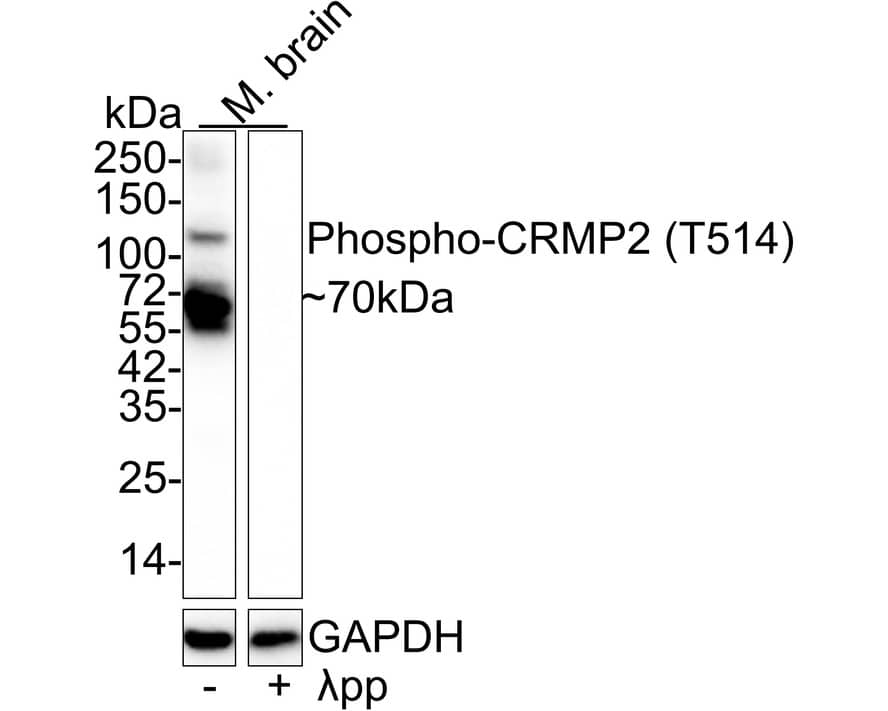 Western blot analysis on different lysates with NBP3-32758 at 1/1,000 dilution. Lane 1: Mouse brain tissue lysate Lane 2: Mouse brain tissue lysate, the membrane treated with  lambda pp for 1 hour Lysates/proteins at 30 µg/Lane. Predicted band size: 62 kDa Observed band size: 70 kDa Exposure time: 5 seconds; 4-20% SDS-PAGE gel. Proteins were transferred to a PVDF membrane and blocked with 5% NFDM/TBST for 1 hour at room temperature. NBP3-32758 at 1/1,000 dilution was used in 5% NFDM/TBST at 4℃ overnight. Goat Anti-Rabbit IgG [HRP] Secondary Antibody at 1/50,000 dilution was used for 1 hour at room temperature.