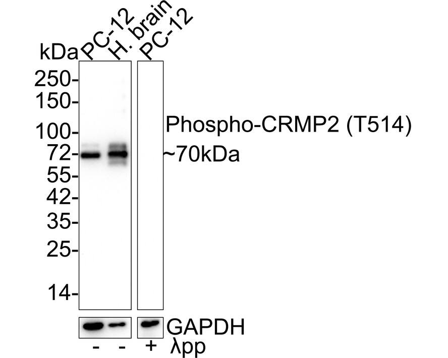 Western Blot: CRMP2 [p Thr514] Antibody (JE57-25) [NBP3-32758] - Western blot analysis of CRMP2 on different lysates with Rabbit anti-CRMP2 antibody (NBP3-32758) at 1/1,000 dilution. Lane 1: PC-12 cell lysate (20 ug/Lane) Lane 2: Human brain tissue lysate (30 ug/Lane) Lane 3: PC-12 treated  pp for 1 hour cell lysate (20 ug/Lane) Predicted band size: 62 kDa Observed band size: 70 kDa Exposure time: 45 seconds; 4-20% SDS-PAGE gel. Proteins were transferred to a PVDF membrane and blocked with 5% NFDM/TBST for 1 hour at room temperature. The primary antibody (NBP3-32758) at 1/1,000 dilution was used in 5% NFDM/TBST at 4C overnight. Goat Anti-Rabbit IgG - HRP Secondary Antibody at 1/50,000 dilution was used for 1 hour at room temperature.