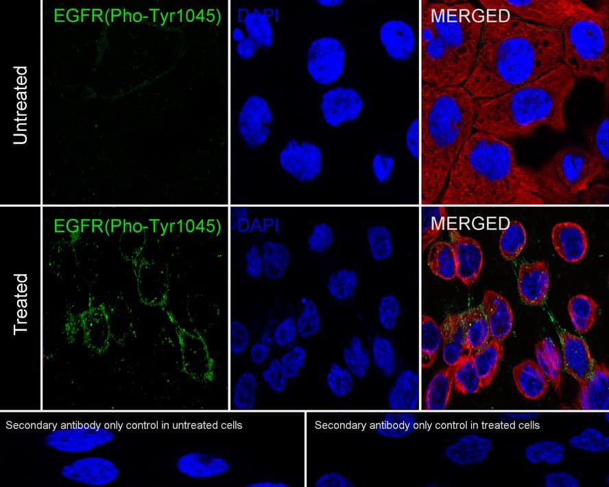 Immunocytochemistry/ Immunofluorescence: EGFR [p Tyr1045] Antibody (PSH03-28) [NBP3-32760] - Immunocytochemistry analysis of A431 treated with or without 100ng/mL EGF for 60 minutes cells labeling EGFR with Rabbit anti-EGFR antibody (NBP3-32760) at 1/100 dilution. Cells were fixed in 100% precooled methanol for 5 minutes at room temperature, then blocked with 1% BSA in 10% negative goat serum for 1 hour at room temperature. Cells were then incubated with Rabbit anti-EGFR antibody (NBP3-32760) at 1/100 dilution in 1% BSA in PBST overnight at 4 ℃. Goat Anti-Rabbit IgG H&L (iFluor™ 488) was used as the secondary antibody at 1/1,000 dilution. PBS instead of the primary antibody was used as the secondary antibody only control. Nuclear DNA was labelled in blue with DAPI. Beta tubulin (red) was stained at 1/100 dilution overnight at +4℃. Goat Anti-Mouse IgG H&L (iFluor™ 594) was used as the secondary antibody at 1/1,000 dilution.