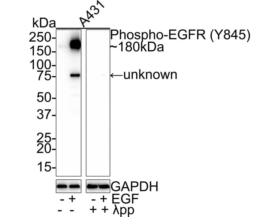 Western Blot: EGFR [p Tyr845] Antibody (JE46-77) [NBP3-32761] - Western blot analysis of EGFR on different lysates with Rabbit anti-EGFR antibody (NBP3-32761) at 1/1,000 dilution. Lane 1: A431 whole cell lysate Lane 2: A431 treated with 100ng/mL EGF for 10 minutes whole cell lysate Lane 3: A431 whole cell lysate treated with  pp for 1 hour Lane 4: A431 treated with 100ng/mL EGF for 10 minutes whole cell lysate treated with  pp for 1 hour Lysates/proteins at 20 ug/Lane. Predicted band size: 134 kDa Observed band size: 180/75 kDa Exposure time: 3 minutes; 4-20% SDS-PAGE gel. Proteins were transferred to a PVDF membrane and blocked with 5% NFDM/TBST for 1 hour at room temperature. The primary antibody (NBP3-32761) at 1/1,000 dilution was used in 5% NFDM/TBST at room temperature for 2 hours. Goat Anti-Rabbit IgG - HRP Secondary Antibody at 1:100,000 dilution was used for 1 hour at room temperature.