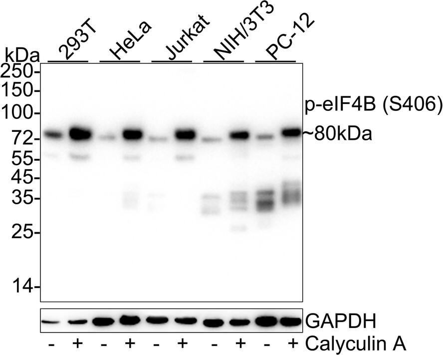 Western blot analysis on different lysates with NBP3-32763 at 1/50,000 dilution. Lane 1: 293T cell lysate Lane 2: 293T treated with 100nM Calyculin A for 15 minutes cell lysate Lane 3: HeLa cell lysate Lane 4: HeLa treated with 100ng/mL Calyculin A for 30 minutes cell lysate Lane 5: Jurkat cell lysate Lane 6: Jurkat treated with 100nM Calyculin A for 30 minutes cell lysate Lane 7: NIH/3T3 cell lysate Lane 8: NIH/3T3 treated with 100nM Calyculin A for 30 minutes cell lysate Lane 9: PC-12 cell lysate Lane 10: PC-12 treated with 100nM Calyculin A for 30 minutes cell lysate Lysates/proteins at 20 µg/Lane. Predicted band size: 69 kDa Observed band size: 80 kDa Exposure time: 21 seconds;  4-20% SDS-PAGE gel. Proteins were transferred to a PVDF membrane and blocked with 5% NFDM/TBST for 1 hour at room temperature. NBP3-32763 at 1/50,000 dilution was used in 5% NFDM/TBST at 4℃ overnight. Goat Anti-Rabbit IgG [HRP] Secondary Antibody at 1/50,000 dilution was used for 1 hour at room temperature.