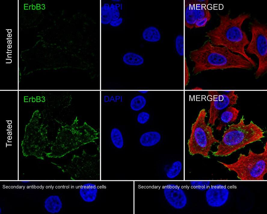 Immunocytochemistry/ Immunofluorescence: ErbB3/Her3 [p Tyr1289] Antibody (JE51-25) [NBP3-32765] - Immunocytochemistry analysis of MCF7 cells serum starved for 6 hours then add 10nM Neuregulin-1 for 10 minutes labeling ErbB3/Her3 with Rabbit anti-ErbB3/Her3 antibody (NBP3-32765) at 1/100 dilution. Cells were fixed in 4% paraformaldehyde for 20 minutes at room temperature, permeabilized with 0.1% Triton X-100 in PBS for 5 minutes at room temperature, then blocked with 1% BSA in 10% negative goat serum for 1 hour at room temperature. Cells were then incubated with Rabbit anti-ErbB3/Her3 antibody (NBP3-32765) at 1/100 dilution in 1% BSA in PBST overnight at 4 ℃. Goat Anti-Rabbit IgG H&L (iFluor™ 488) was used as the secondary antibody at 1/1,000 dilution. PBS instead of the primary antibody was used as the secondary antibody only control. Nuclear DNA was labelled in blue with DAPI. Beta tubulin (red) was stained at 1/100 dilution overnight at +4℃. Goat Anti-Mouse IgG H&L (iFluor™ 594) was used as the secondary antibody at 1/1,000 dilution.