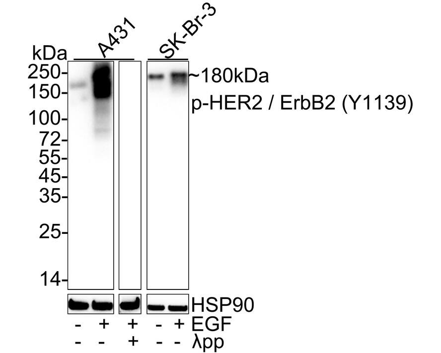 Western Blot: ErbB2/Her2 [p Tyr1139] Antibody (JE60-90) [NBP3-32768] - Western blot analysis of ErbB2/Her2 on different lysates with Rabbit anti-ErbB2/Her2 antibody (NBP3-32768) at 1/1,000 dilution. Lane 1: A431 cell lysate Lane 2: A431 treated with 100ng/mL EGF for 10 minutes cell lysate Lane 3: A431 treated with 100ng/mL EGF for 10 minutes cell lysate, then the membrane treated with  pp for 1 hour Lane 4: SK-Br-3 cell lysate Lane 5: SK-Br-3 starved for 4 hours add 200ng/mL EGF for 15 minutes cell lysate Lysates/proteins at 20 ug/Lane. Predicted band size: 138 kDa Observed band size: 180 kDa Exposure time: 10 seconds; ECL; 4-20% SDS-PAGE gel. Proteins were transferred to a PVDF membrane and blocked with 5% NFDM/TBST for 1 hour at room temperature. The primary antibody (NBP3-32768) at 1/1,000 dilution was used in 5% NFDM/TBST at 4C overnight. Goat Anti-Rabbit IgG - HRP Secondary Antibody at 1/50,000 dilution was used for 1 hour at room temperature.