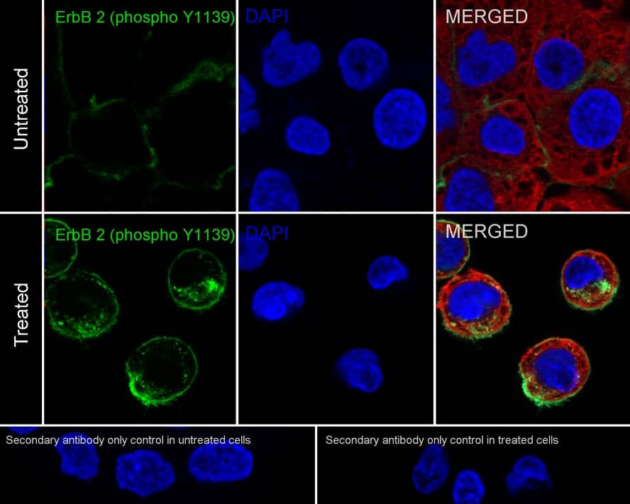 Immunocytochemistry/ Immunofluorescence: ErbB2/Her2 [p Tyr1139] Antibody (JE60-90) [NBP3-32768] - Immunocytochemistry analysis of A431 cells treated with or without 100ng/mL EGF for 10 minutes labeling ErbB2/Her2 with Rabbit anti-ErbB2/Her2 antibody (NBP3-32768) at 1/5,000 dilution. Cells were fixed in 4% paraformaldehyde for 20 minutes at room temperature, permeabilized with 0.1% Triton X-100 in PBS for 5 minutes at room temperature, then blocked with 1% BSA in 10% negative goat serum for 1 hour at room temperature. Cells were then incubated with Rabbit anti-ErbB2/Her2 antibody (NBP3-32768) at 1/5,000 dilution in 1% BSA in PBST overnight at 4 ℃. Goat Anti-Rabbit IgG H&L (iFluor™ 488) was used as the secondary antibody at 1/1,000 dilution. PBS instead of the primary antibody was used as the secondary antibody only control. Nuclear DNA was labelled in blue with DAPI. Beta tubulin (red) was stained at 1/100 dilution overnight at +4℃. Goat Anti-Mouse IgG H&L (iFluor™ 594) was used as the secondary antibody at 1/1,000 dilution.