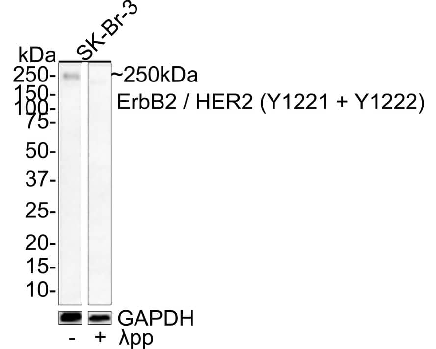 Western Blot: ErbB2/Her2 [p Tyr1221, p Tyr1222] Antibody (JE44-12) [NBP3-32769] - Western blot analysis of ErbB2/Her2 on different lysates with Rabbit anti-ErbB2/Her2 antibody (NBP3-32769) at 1/1,000 dilution. Lane 1: SK-Br-3 whole cell lysate Lane 2: SK-Br-3 treated with  pp for 1 hour whole cell lysate Lysates/proteins at 20 ug/Lane. Predicted band size: 138 kDa Observed band size: 250 kDa Exposure time: 3 minutes; 4-20% SDS-PAGE gel. Proteins were transferred to a PVDF membrane and blocked with 5% NFDM/TBST for 1 hour at room temperature. The primary antibody (NBP3-32769) at 1/1,000 dilution was used in 5% NFDM/TBST at room temperature for 2 hours. Goat Anti-Rabbit IgG - HRP Secondary Antibody at 1:100,000 dilution was used for 1 hour at room temperature.