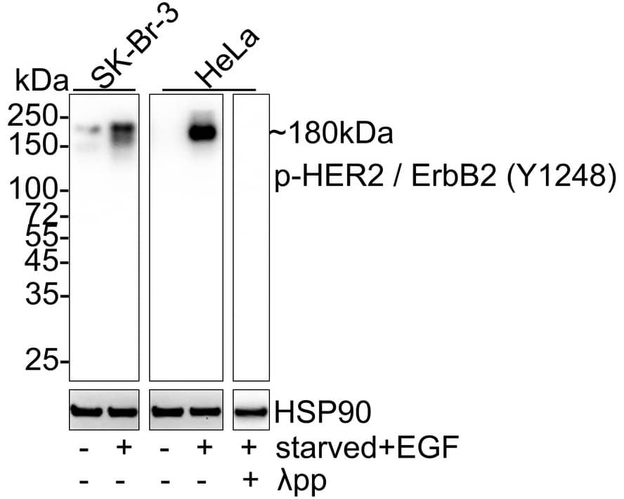 Western Blot: ErbB2/Her2 [p Tyr1248] Antibody (PSH04-03) [NBP3-32770] - Western blot analysis of ErbB2/Her2 on different lysates with Rabbit anti-ErbB2/Her2 antibody (NBP3-32770) at 1/1,000 dilution. Lane 1: SK-Br-3 cell lysate Lane 2: SK-Br-3 starved for 4 hours add 200ng/mL EGF for 15 minutes cell lysate Lane 3: HeLa cell lysate Lane 4: HeLa starved for 4 hours add 200ng/mL EGF for 15 minutes cell lysate Lane 5: HeLa starved for 4 hours add 200ng/mL EGF for 15 minutes cell lysate, then the membrane treated with  pp for 1 hour Lysates/proteins at 20 ug/Lane. Predicted band size: 138 kDa Observed band size: 180 kDa Exposure time: 24 seconds; 4-20% SDS-PAGE gel. Proteins were transferred to a PVDF membrane and blocked with 5% NFDM/TBST for 1 hour at room temperature. The primary antibody (NBP3-32770) at 1/1,000 dilution was used in 5% NFDM/TBST at 4C overnight. Goat Anti-Rabbit IgG - HRP Secondary Antibody at 1/50,000 dilution was used for 1 hour at room temperature.