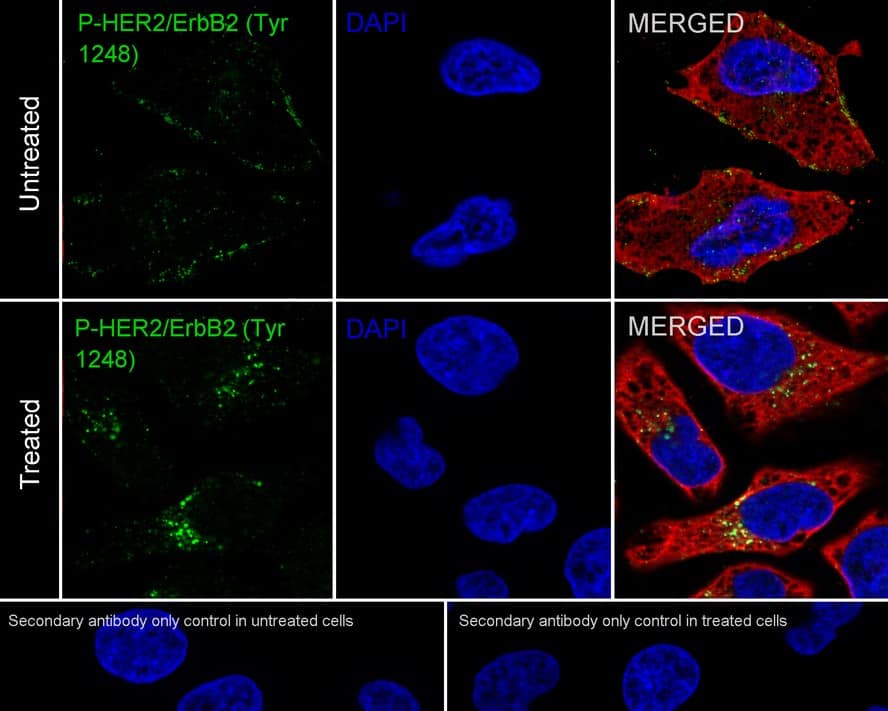 Immunocytochemistry/ Immunofluorescence: ErbB2/Her2 [p Tyr1248] Antibody (PSH04-03) [NBP3-32770] - Immunocytochemistry analysis of HeLa cells starved for 4 hours add 200ng/mL EGF for 15 minutes labeling ErbB2/Her2 with Rabbit anti-ErbB2/Her2 antibody (NBP3-32770) at 1/100 dilution. Cells were fixed in 4% paraformaldehyde for 20 minutes at room temperature, permeabilized with 0.1% Triton X-100 in PBS for 5 minutes at room temperature, then blocked with 1% BSA in 10% negative goat serum for 1 hour at room temperature. Cells were then incubated with Rabbit anti-ErbB2/Her2 antibody (NBP3-32770) at 1/100 dilution in 1% BSA in PBST overnight at 4 ℃. Goat Anti-Rabbit IgG H&L (iFluor™ 488) was used as the secondary antibody at 1/1,000 dilution. PBS instead of the primary antibody was used as the secondary antibody only control. Nuclear DNA was labelled in blue with DAPI. Beta tubulin (red) was stained at 1/100 dilution overnight at +4℃. Goat Anti-Mouse IgG H&L (iFluor™ 594) was used as the secondary antibody at 1/1,000 dilution.