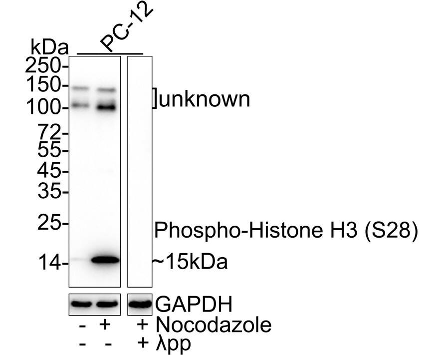 Western blot analysis on different lysates with NBP3-32771 at 1/1,000 dilution. Lane 1: PC-12 cell lysate Lane 2: PC-12 treated with 100ng/mL Nocodazole for 18 hours cell lysate Lane 3: PC-12 treated with 100ng/mL Nocodazole for 18 hours，then the membrane treated with  lambda pp for 1 hour cell lysate Lysates/proteins at 20 µg/Lane. Predicted band size: 15 kDa Observed band size: 15 kDa Exposure time: 59 seconds;  4-20% SDS-PAGE gel. Proteins were transferred to a PVDF membrane and blocked with 5% NFDM/TBST for 1 hour at room temperature. NBP3-32771 at 1/1,000 dilution was used in 5% NFDM/TBST at 4℃ overnight. Goat Anti-Rabbit IgG [HRP] Secondary Antibody at 1/50,000 dilution was used for 1 hour at room temperature.