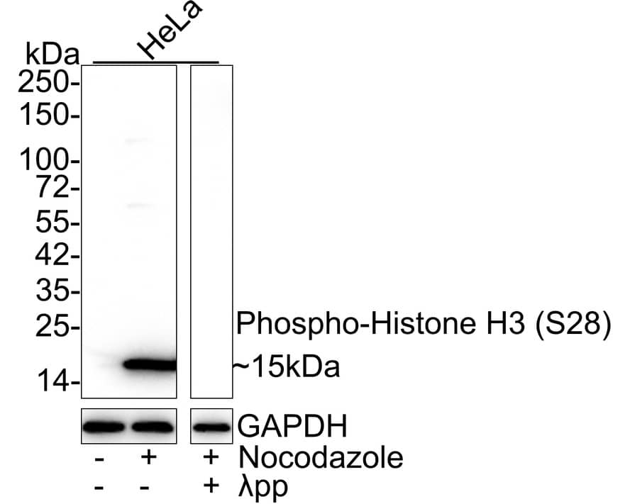 Western Blot: Histone H3 [p Ser28] Antibody (JE56-06) [NBP3-32771] - Western blot analysis of Histone H3 on different lysates with Rabbit anti-Histone H3 antibody (NBP3-32771) at 1/1,000 dilution. Lane 1: HeLa cell lysate Lane 2: HeLa treated with 100ng/mL Nocodazole for 18 hours cell lysate Lane 3: HeLa treated with 100ng/mL Nocodazole for 18 hours,then treated with  pp for 1 hour cell lysate Lysates/proteins at 20 ug/Lane. Predicted band size: 15 kDa Observed band size: 15 kDa Exposure time: 25 seconds; 4-20% SDS-PAGE gel. Proteins were transferred to a PVDF membrane and blocked with 5% NFDM/TBST for 1 hour at room temperature. The primary antibody (NBP3-32771) at 1/1,000 dilution was used in 5% NFDM/TBST at 4C overnight. Goat Anti-Rabbit IgG - HRP Secondary Antibody at 1/50,000 dilution was used for 1 hour at room temperature.
