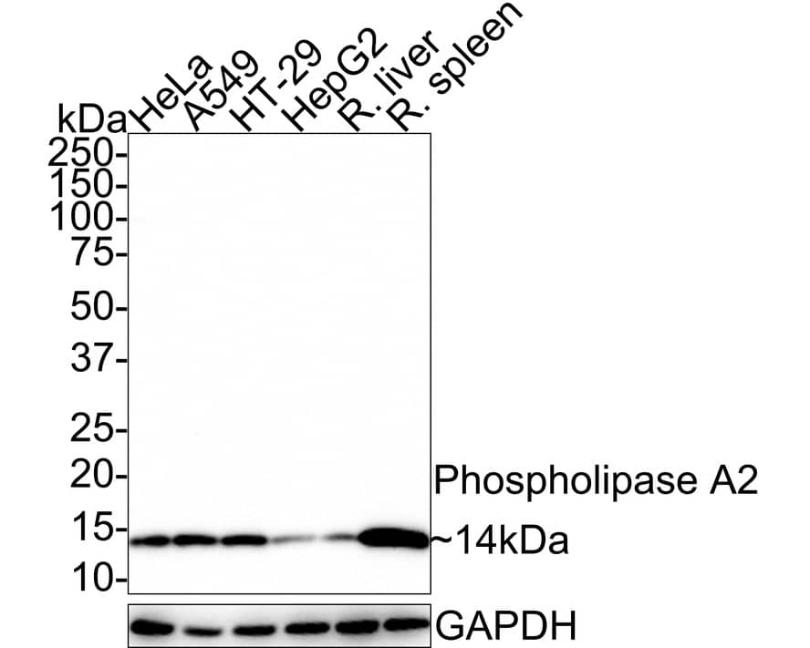 Western Blot: PLA2G2A Antibody (JE41-02) [NBP3-32775] - Western blot analysis of PLA2G2A on different lysates with Rabbit anti-PLA2G2A antibody (NBP3-32775) at 1/1,000 dilution. Lane 1: HeLa cell lysate (20 ug/Lane) Lane 2: A549 cell lysate (20 ug/Lane) Lane 3: HT-29 cell lysate (20 ug/Lane) Lane 4: HepG2 cell lysate (20 ug/Lane) Lane 5: Rat liver tissue lysate (40 ug/Lane) Lane 6: Rat spleen tissue lysate (40 ug/Lane) Predicted band size: 16 kDa Observed band size: 14 kDa Exposure time: 1 minute 40 seconds; 4-20% SDS-PAGE gel. Proteins were transferred to a PVDF membrane and blocked with 5% NFDM/TBST for 1 hour at room temperature. The primary antibody (NBP3-32775) at 1/1,000 dilution was used in 5% NFDM/TBST at room temperature for 2 hours. Goat Anti-Rabbit IgG - HRP Secondary Antibody at 1:100,000 dilution was used for 1 hour at room temperature.