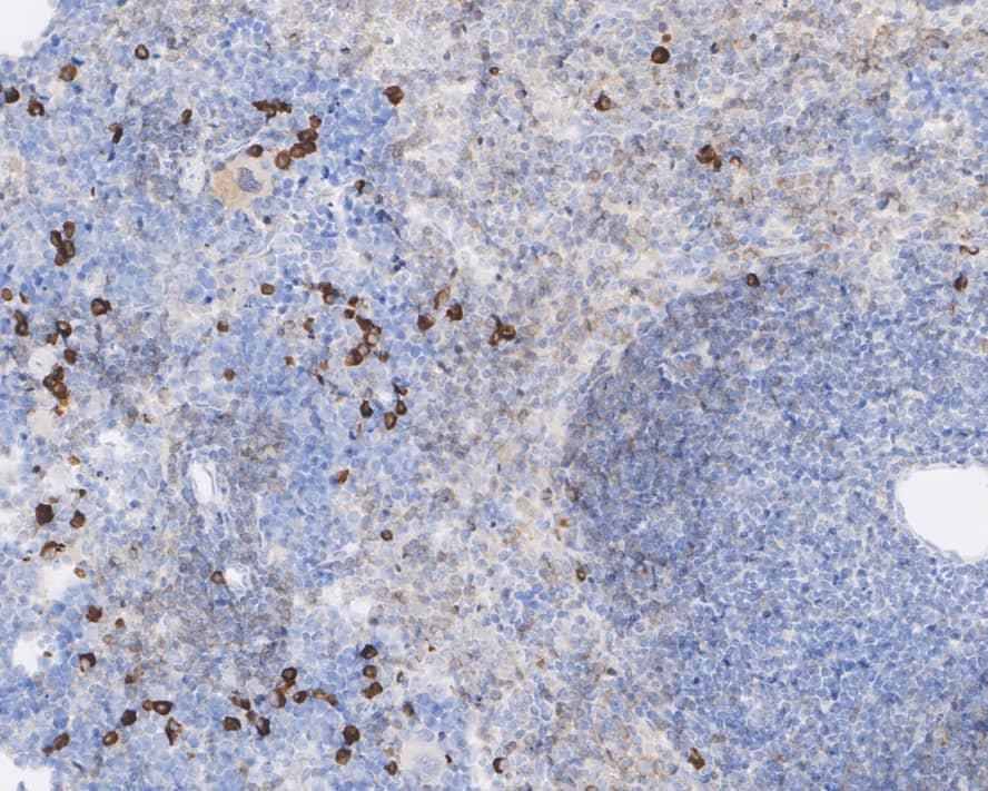 Immunohistochemistry: PLA2G2A Antibody (JE41-02) [NBP3-32775] - Immunohistochemical analysis of paraffin-embedded mouse spleen tissue with Rabbit anti-PLA2G2A antibody (NBP3-32775) at 1/1,000 dilution. The section was pre-treated using heat mediated antigen retrieval with Tris-EDTA buffer (pH 9.0) for 20 minutes. The tissues were blocked in 1% BSA for 20 minutes at room temperature, washed with ddH2O and PBS, and then probed with the primary antibody (NBP3-32775) at 1/1,000 dilution for 1 hour at room temperature. The detection was performed using an HRP conjugated compact polymer system. DAB was used as the chromogen. Tissues were counterstained with hematoxylin and mounted with DPX.