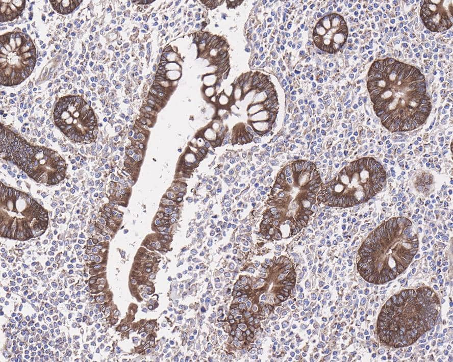 Immunohistochemistry: PLC-beta 3 Antibody (JE39-14) [NBP3-32776] - Immunohistochemical analysis of paraffin-embedded human small intestine tissue with Rabbit anti-PLC-beta 3 antibody (NBP3-32776) at 1/2,000 dilution. The section was pre-treated using heat mediated antigen retrieval with Tris-EDTA buffer (pH 9.0) for 20 minutes. The tissues were blocked in 1% BSA for 20 minutes at room temperature, washed with ddH2O and PBS, and then probed with the primary antibody (NBP3-32776) at 1/2,000 dilution for 1 hour at room temperature. The detection was performed using an HRP conjugated compact polymer system. DAB was used as the chromogen. Tissues were counterstained with hematoxylin and mounted with DPX.