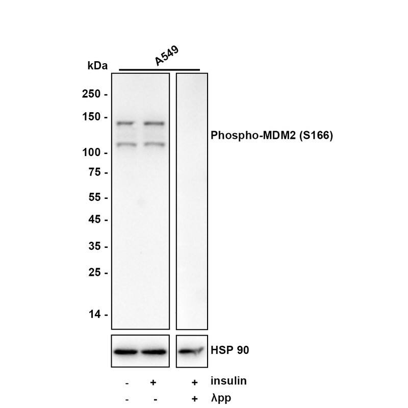 Western blot analysis on different lysates with NBP3-32777 at 1/1,000 dilution. Lane 1: A549 cell lysate Lane 2: A549 treated with 1μg/mL insulin for 2.5 hours cell lysate Lane 3: A549 treated with 1μg/mL insulin for 2.5 hours cell lysate, then the membrane treated with  lambda pp for 1 hour Lysates/proteins at 20 µg/Lane. Predicted band size: 55 kDa Observed band size: 110/140 kDa Exposure time: 57 seconds; 4-20% SDS-PAGE gel. Proteins were transferred to a PVDF membrane and blocked with 5% NFDM/TBST for 1 hour at room temperature. NBP3-32777 at 1/1,000 dilution was used in 5% NFDM/TBST at 4℃ overnight. Goat Anti-Rabbit IgG [HRP] Secondary Antibody at 1/50,000 dilution was used for 1 hour at room temperature.