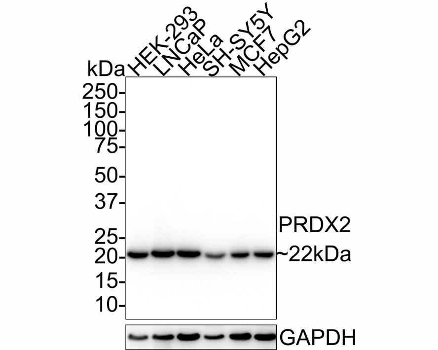 Western Blot: Peroxiredoxin 2 Antibody (7F2-R) [NBP3-32778] - Western blot analysis of Peroxiredoxin 2 on different lysates with Mouse anti-Peroxiredoxin 2 antibody (NBP3-32778) at 1/1,000 dilution. Lane 1: HEK-293 cell lysate Lane 2: LNCaP cell lysate Lane 3: HeLa cell lysate Lane 4: SH-SY5Y cell lysate Lane 5: MCF7 cell lysate Lane 6: HepG2 cell lysate Lysates/proteins at 20 ug/Lane. Predicted band size: 22 kDa Observed band size: 22 kDa Exposure time: 5 seconds; 4-20% SDS-PAGE gel. Proteins were transferred to a PVDF membrane and blocked with 5% NFDM/TBST for 1 hour at room temperature. The primary antibody (NBP3-32778) at 1/1,000 dilution was used in 5% NFDM/TBST at room temperature for 2 hours. Goat Anti-Mouse IgG - HRP Secondary Antibody at 1/50,000 dilution was used for 1 hour at room temperature.