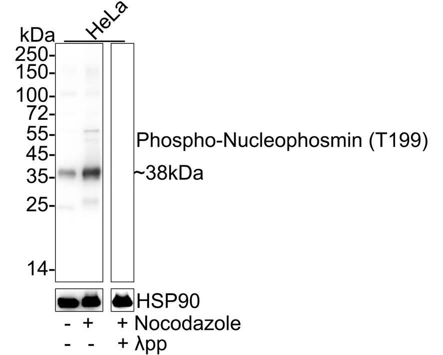 Western blot analysis on different lysates with NBP3-32780 at 1/2,000 dilution. Lane 1: HeLa cell lysate Lane 2: HeLa treated with 100ng/mL Nocodazole for 17 hours cell lysate Lane 3: HeLa treated with 100ng/mL Nocodazole for 17 hours cell lysate, then the membrane treated with  lambda pp for 1 hour Lysates/proteins at 15 µg/Lane. Predicted band size: 33 kDa Observed band size: 38 kDa Exposure time: 2 seconds;  4-20% SDS-PAGE gel. Proteins were transferred to a PVDF membrane and blocked with 5% NFDM/TBST for 1 hour at room temperature. NBP3-32780 at 1/2,000 dilution was used in 5% NFDM/TBST at 4℃ overnight. Goat Anti-Rabbit IgG [HRP] Secondary Antibody at 1/50,000 dilution was used for 1 hour at room temperature.