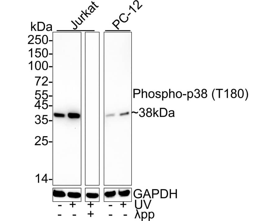 Western blot analysis on different lysates with NBP3-32781 at 1/1,000 dilution. Lane 1: Jurkat cell lysate Lane 2: Jurkat treated with UV for 1 hour cell lysate Lane 3: Jurkat treated with UV for 1 hour cell lysate, then the membrane treated with  lambda pp for 1 hour Lane 4: PC-12 cell lysate Lane 5: PC-12 treated with UV for 1 hour cell lysate Lysates/proteins at 20 µg/Lane. Predicted band size: 41 kDa Observed band size: 38 kDa Exposure time: 2 minutes;  4-20% SDS-PAGE gel. Proteins were transferred to a PVDF membrane and blocked with 5% NFDM/TBST for 1 hour at room temperature. NBP3-32781 at 1/1,000 dilution was used in 5% NFDM/TBST at 4℃ overnight. Goat Anti-Rabbit IgG [HRP] Secondary Antibody at 1/50,000 dilution was used for 1 hour at room temperature.