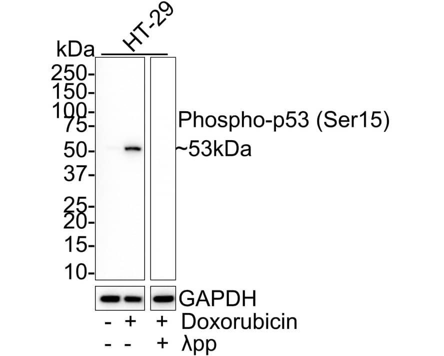 Western blot analysis on different lysates with NBP3-32782 at 1/1,000 dilution. Lane 1: HT-29 cell lysate Lane 2: HT-29 treated with 0.5μM Doxorubicin for 24 hours cell lysate Lane 3: HT-29 treated with 0.5μM Doxorubicin for 24 hours, then treated with  lambda pp for 1 hour cell lysate Lysates/proteins at 20 µg/Lane. Predicted band size: 53 kDa Observed band size: 53 kDa Exposure time: 1 minute 46 seconds; 4-20% SDS-PAGE gel. Proteins were transferred to a PVDF membrane and blocked with 5% NFDM/TBST for 1 hour at room temperature. NBP3-32782 at 1/1,000 dilution was used in 5% NFDM/TBST at room temperature for 2 hours. Goat Anti-Rabbit IgG [HRP] Secondary Antibody at 1/50,000 dilution was used for 1 hour at room temperature.