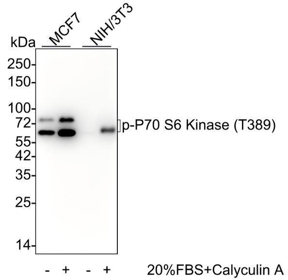 Western blot analysis on different lysates with NBP3-32783 at 1/2,000 dilution and competitor's antibody at 1/2,000 dilution. Lane 1: MCF7 cell lysate Lane 2: MCF7 treated with 20% FBS overnight then add 100nM Calyculin A for 30 minutes cell lysate Lane 3: NIH/3T3 cell lysate Lane 4: NIH/3T3 treated with 20% FBS overnight then add 100nM Calyculin A for 30 minutes cell lysate Lysates/proteins at 15 µg/Lane. Predicted band size: 59 kDa Observed band size: 70/85 kDa Exposure time: Lane 1-4 (left): 1 minute 2 seconds; Lane 1-4 (right): 3 minutes;  4-20% SDS-PAGE gel. Proteins were transferred to a PVDF membrane and blocked with 5% NFDM/TBST for 1 hour at room temperature. NBP3-32783 at 1/2,000 dilution and competitor's antibody at 1/2,000 dilution were used in 5% NFDM/TBST at 4℃ overnight. Goat Anti-Rabbit IgG [HRP] Secondary Antibody at 1/50,000 dilution was used for 1 hour at room temperature.