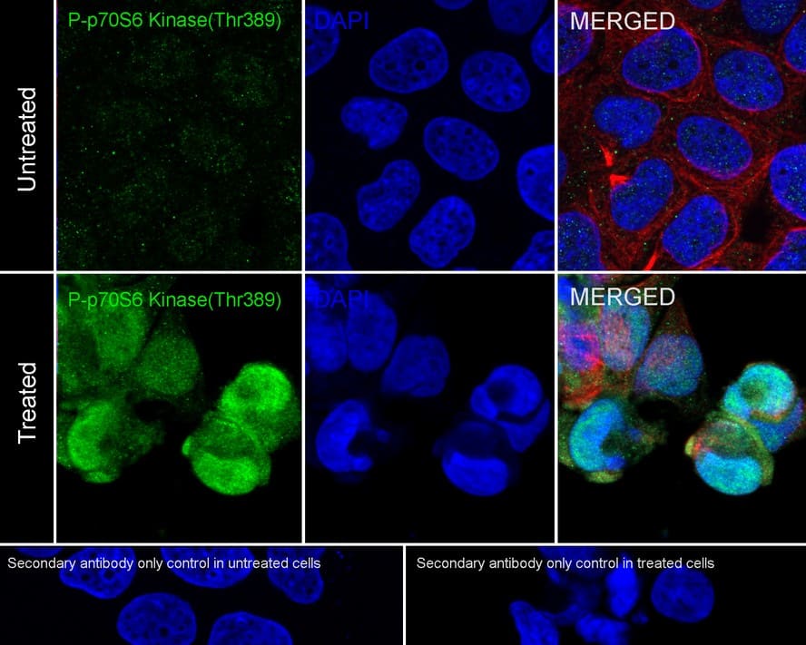 Immunocytochemistry/ Immunofluorescence: p70 S6 Kinase/S6K [p Thr389] Antibody (PSH02-23) [NBP3-32783] - Immunocytochemistry analysis of MCF7 cells treated with or without 20% FBS overnight then add 100nM Calyculin A for 30 minutes labeling p70 S6 Kinase/S6K with Rabbit anti-p70 S6 Kinase/S6K antibody (NBP3-32783) at 1/100 dilution. Cells were fixed in 4% paraformaldehyde for 20 minutes at room temperature, permeabilized with 0.1% Triton X-100 in PBS for 5 minutes at room temperature, then blocked with 1% BSA in 10% negative goat serum for 1 hour at room temperature. Cells were then incubated with Rabbit anti-p70 S6 Kinase/S6K antibody (NBP3-32783) at 1/100 dilution in 1% BSA in PBST overnight at 4 ℃. Goat Anti-Rabbit IgG H&L (iFluor™ 488) was used as the secondary antibody at 1/1,000 dilution. PBS instead of the primary antibody was used as the secondary antibody only control. Nuclear DNA was labelled in blue with DAPI. Beta tubulin (red) was stained at 1/100 dilution overnight at +4℃. Goat Anti-Mouse IgG H&L (iFluor™ 594) was used as the secondary antibody at 1/1,000 dilution.