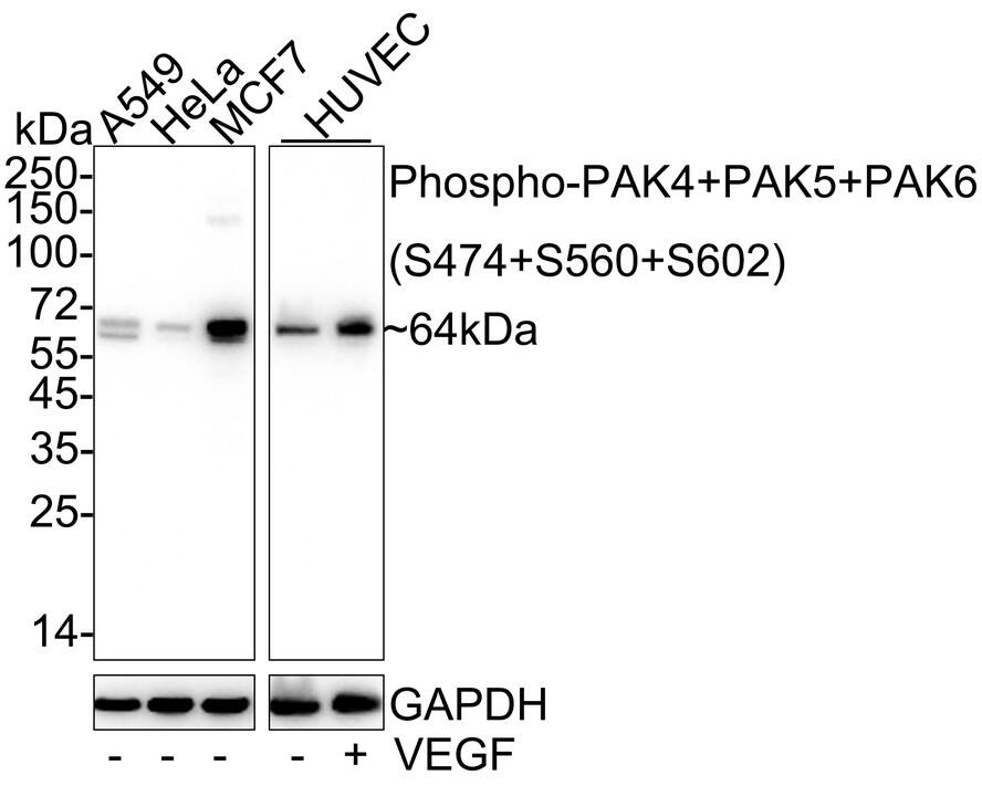 Western Blot: PAK4+5+6 [p Ser602, p Ser474, p Ser560] Antibody (JE57-42) [NBP3-32784] - Western blot analysis of PAK4+5+6 on different lysates with Rabbit anti-PAK4+5+6 antibody (NBP3-32784) at 1/1,000 dilution. Lane 1: A549 cell lysate (20 ug/Lane) Lane 2: HeLa cell lysate (20 ug/Lane) Lane 3: MCF7 cell lysate (20 ug/Lane) Lane 4: HUVEC cell lysate (10 ug/Lane) Lane 5: HUVEC treated with 50ng/mL VEGF for 2 minutes cell lysate (30 ug/Lane) Predicted band size: 64/81/75 kDa Observed band size: 64 kDa Exposure time: 30 seconds; ECL; 4-20% SDS-PAGE gel. Proteins were transferred to a PVDF membrane and blocked with 5% NFDM/TBST for 1 hour at room temperature. The primary antibody (NBP3-32784) at 1/1,000 dilution was used in 5% NFDM/TBST at 4C overnight. Goat Anti-Rabbit IgG - HRP Secondary Antibody at 1/50,000 dilution was used for 1 hour at room temperature.