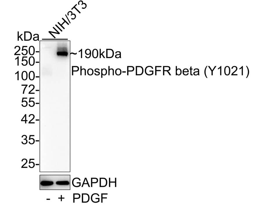 Western blot analysis on different lysates with NBP3-32786 at 1/1,000 dilution. Lane 1: NIH/3T3 whole cell lysate Lane 2: NIH/3T3 treated with 100 ng/mL PDGF for 5 minutes whole cell lysate Lysates/proteins at 20 µg/Lane. Predicted band size: 124 kDa Observed band size: 190 kDa Exposure time: 1 minute; 4-20% SDS-PAGE gel. Proteins were transferred to a PVDF membrane and blocked with 5% NFDM/TBST for 1 hour at room temperature. NBP3-32786 at 1/1,000 dilution was used in 5% NFDM/TBST at room temperature for 2 hours. Goat Anti-Rabbit IgG [HRP] Secondary Antibody at 1:50,000 dilution was used for 1 hour at room temperature.