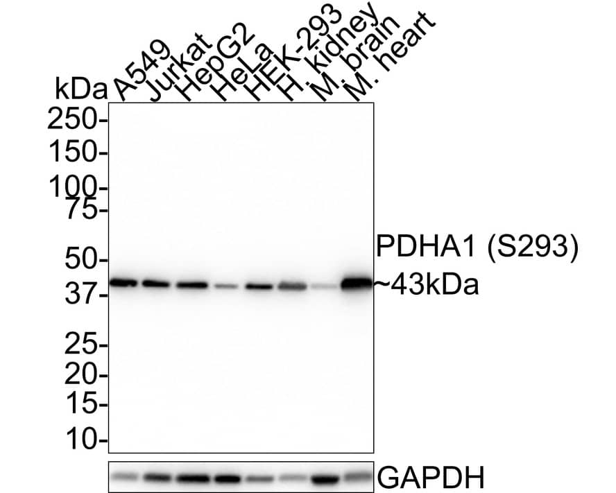 Western Blot: Pyruvate Dehydrogenase E1-alpha subunit [p Ser293] Antibody (JE58-27) [NBP3-32787] - Western blot analysis of Pyruvate Dehydrogenase E1-alpha subunit on different lysates with Rabbit anti-Pyruvate Dehydrogenase E1-alpha subunit antibody (NBP3-32787) at 1/1,000 dilution. Lane 1: A549 cell lysate (20 ug/Lane) Lane 2: Jurkat cell lysate (20 ug/Lane) Lane 3: HepG2 cell lysate (20 ug/Lane) Lane 4: HeLa cell lysate (20 ug/Lane) Lane 5: HEK-293 cell lysate (20 ug/Lane) Lane 6: Human kidney tissue lysate (40 ug/Lane) Lane 7: Mouse brain tissue lysate (40 ug/Lane) Lane 8: Mouse heart tissue lysate (40 ug/Lane) Predicted band size: 43 kDa Observed band size: 43 kDa Exposure time: 39 seconds; 4-20% SDS-PAGE gel. Proteins were transferred to a PVDF membrane and blocked with 5% NFDM/TBST for 1 hour at room temperature. The primary antibody (NBP3-32787) at 1/1,000 dilution was used in 5% NFDM/TBST at room temperature for 2 hours. Goat Anti-Rabbit IgG - HRP Secondary Antibody at 1:100,000 dilution was used for 1 hour at room temperature.