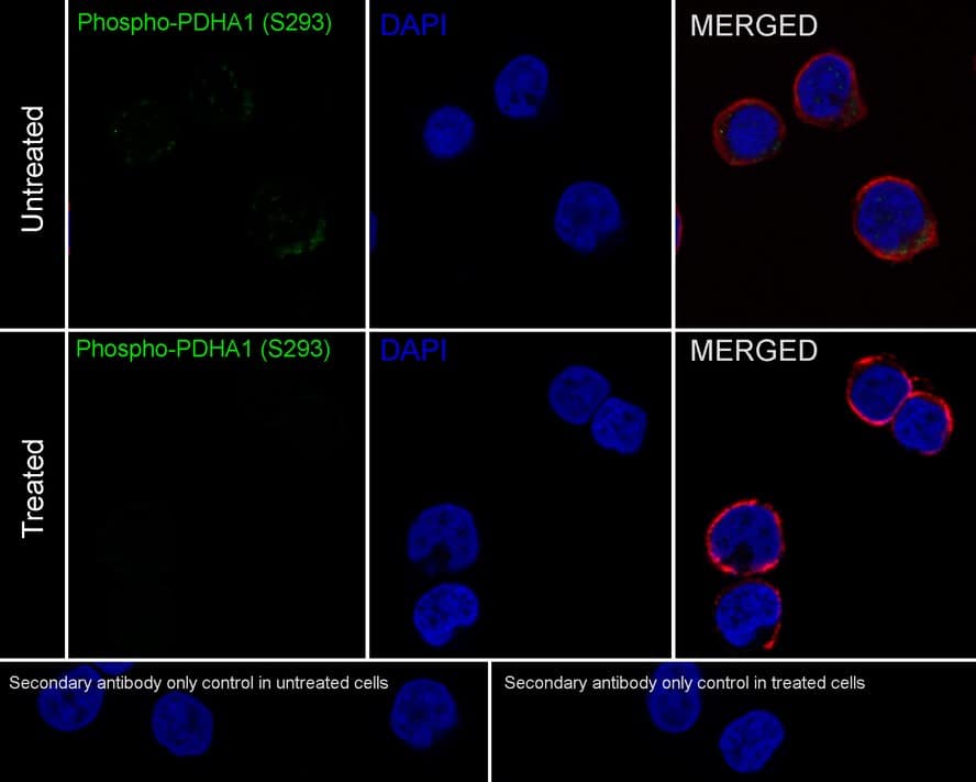 Immunocytochemistry/ Immunofluorescence: Pyruvate Dehydrogenase E1-alpha subunit [p Ser293] Antibody (JE58-27) [NBP3-32787] - Immunocytochemistry analysis of Jurkat cells treated with or without  lambda pp labeling Pyruvate Dehydrogenase E1-alpha subunit with Rabbit anti-Pyruvate Dehydrogenase E1-alpha subunit antibody (NBP3-32787) at 1/100 dilution. Cells were fixed in 4% paraformaldehyde for 10 minutes at 37 ℃, permeabilized with 0.05% Triton X-100 in PBS for 20 minutes, and then blocked with 2% negative goat serum for 30 minutes at room temperature. Cells were then incubated with Rabbit anti-Pyruvate Dehydrogenase E1-alpha subunit antibody (NBP3-32787) at 1/100 dilution in 2% negative goat serum overnight at 4 ℃. Goat Anti-Rabbit IgG H&L (iFluor™ 488) was used as the secondary antibody at 1/1,000 dilution. Nuclear DNA was labelled in blue with DAPI. Beta tubulin (red) was stained at 1/200 dilution overnight at +4℃. Goat Anti-Mouse IgG H&L (iFluor™ 594) was used as the secondary antibody at 1/1,000 dilution.