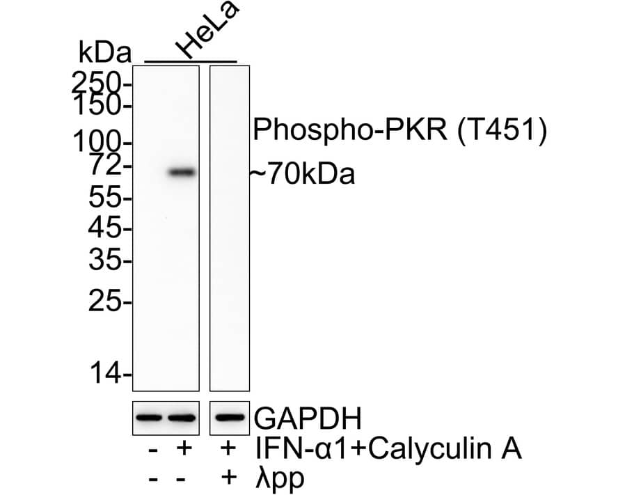 Western blot analysis on different lysates with NBP3-32789 at 1/1,000 dilution. Lane 1: HeLa cell lysate Lane 2: HeLa treated with 10ng/mL IFN-alpha 1 for 18 hours then 100nM Calyculin A for 15 minutes cell lysate Lane 3: HeLa treated with 10ng/mL IFN-alpha 1 for 18 hours then 100nM Calyculin A for 15 minutes cell lysate, then the membrane treated with  lambda pp for 1 hour Lysates/proteins at 20 µg/Lane. Predicted band size: 62 kDa Observed band size: 70 kDa Exposure time: 3 minutes 5 seconds; 4-20% SDS-PAGE gel. Proteins were transferred to a PVDF membrane and blocked with 5% NFDM/TBST for 1 hour at room temperature. NBP3-32789 at 1/1,000 dilution was used in 5% NFDM/TBST at 4℃ overnight. Goat Anti-Rabbit IgG [HRP] Secondary Antibody at 1/50,000 dilution was used for 1 hour at room temperature.