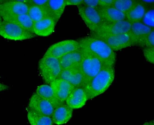Immunocytochemistry/ Immunofluorescence: PTEN [p Ser380] Antibody (JJ08-81) [NBP3-32791] - ICC staining of PTEN in Hela cells (green). Formalin fixed cells were permeabilized with 0.1% Triton X-100 in TBS for 10 minutes at room temperature and blocked with 1% Blocker BSA for 15 minutes at room temperature. Cells were probed with the primary antibody (NBP3-32791, 1/100) for 1 hour at room temperature, washed with PBS. Alexa Fluor®488 Goat anti-Rabbit IgG was used as the secondary antibody at 1/1,000 dilution. The nuclear counter stain is DAPI (blue).