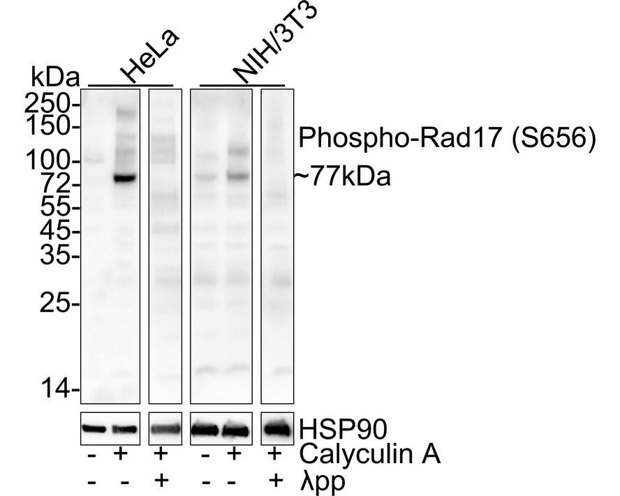 Western Blot: Rad17 [p Ser656] Antibody (JE63-30) [NBP3-32792] - Western blot analysis of Rad17 on different lysates with Rabbit anti-Rad17 antibody (NBP3-32792) at 1/1,000 dilution. Lane 1: HeLa cell lysate Lane 2: HeLa treated with 100ng/mL Calyculin A for 30 minutes cell lysate Lane 3: HeLa treated with 100ng/mL Calyculin A for 30 minutes cell lysate, then the membrane treated with  pp for 1 hour Lane 4: NIH/3T3 cell lysate Lane 5: NIH/3T3 treated with 50ng/mL Calyculin A for 45 minutes cell lysate Lane 6: NIH/3T3 treated with 50ng/mL Calyculin A for 45 minutes cell lysate, then the membrane treated with  pp for 1 hour Lysates/proteins at 20 ug/Lane. Predicted band size: 77 kDa Observed band size: 77 kDa Exposure time: 43 seconds; ECL; 4-20% SDS-PAGE gel. Proteins were transferred to a PVDF membrane and blocked with 5% NFDM/TBST for 1 hour at room temperature. The primary antibody (NBP3-32792) at 1/1,000 dilution was used in 5% NFDM/TBST at 4C overnight. Goat Anti-Rabbit IgG - HRP Secondary Antibody at 1/50,000 dilution was used for 1 hour at room temperature.