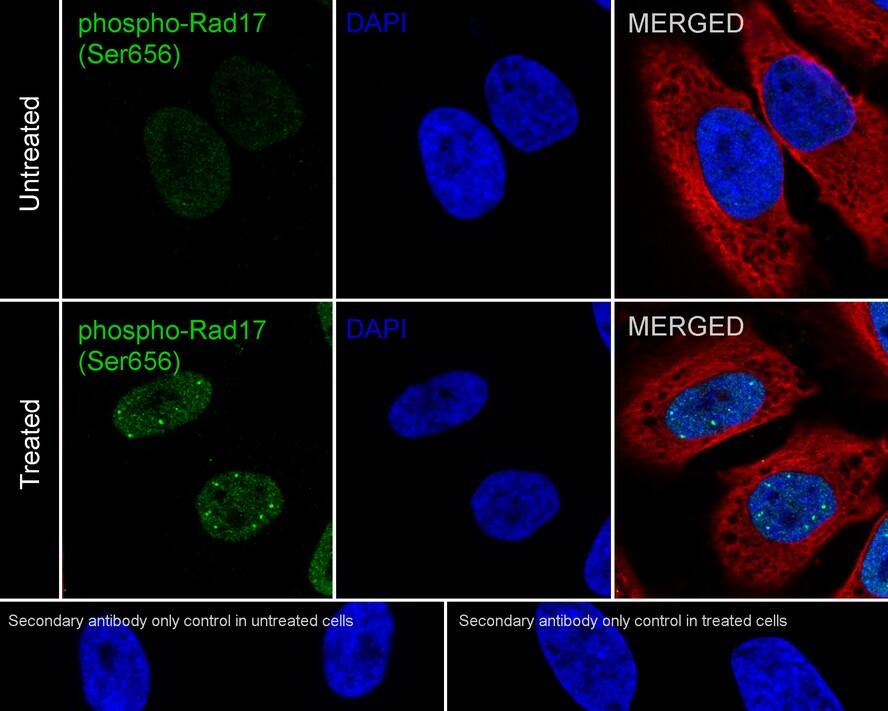 Immunocytochemistry/ Immunofluorescence: Rad17 [p Ser656] Antibody (JE63-30) [NBP3-32792] - Immunocytochemistry analysis of HeLa cells treated with or without 100ng/mL Calyculin A for 30 minutes labeling Rad17 with Rabbit anti-Rad17 antibody (NBP3-32792) at 1/500 dilution. Cells were fixed in 4% paraformaldehyde for 20 minutes at room temperature, permeabilized with 0.1% Triton X-100 in PBS for 5 minutes at room temperature, then blocked with 1% BSA in 10% negative goat serum for 1 hour at room temperature. Cells were then incubated with Rabbit anti-Rad17 antibody (NBP3-32792) at 1/500 dilution in 1% BSA in PBST overnight at 4 ℃. Goat Anti-Rabbit IgG H&L (iFluor™ 488) was used as the secondary antibody at 1/1,000 dilution. PBS instead of the primary antibody was used as the secondary antibody only control. Nuclear DNA was labelled in blue with DAPI.