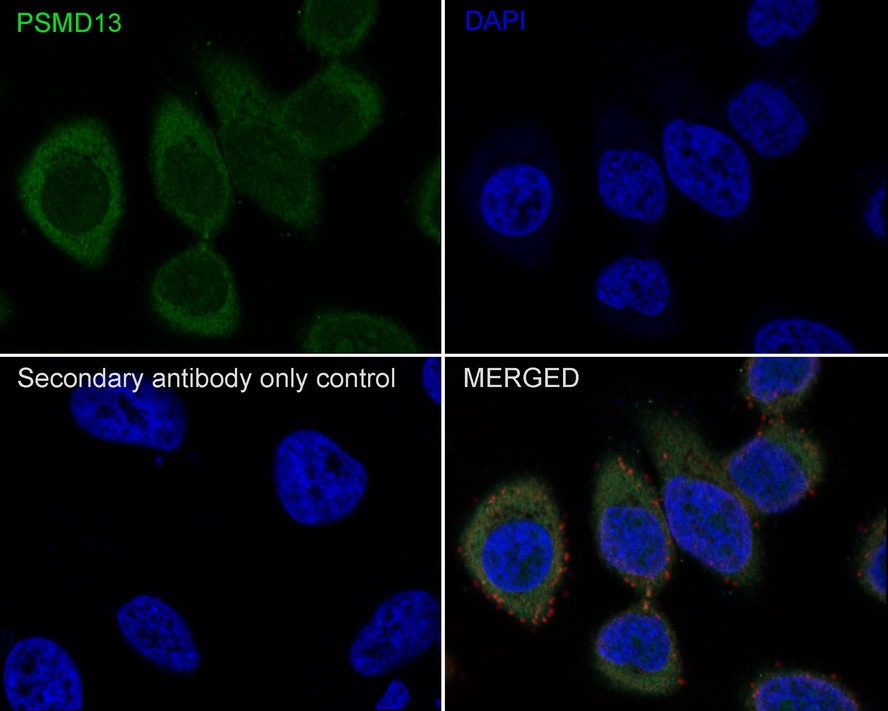 Immunocytochemistry/ Immunofluorescence: PSMD13 Antibody (PSH0-52) [NBP3-32793] - Immunocytochemistry analysis of HeLa cells labeling PSMD13 with Rabbit anti-PSMD13 antibody (NBP3-32793) at 1/200 dilution. Cells were fixed in 4% paraformaldehyde for 10 minutes at 37 ℃, permeabilized with 0.05% Triton X-100 in PBS for 20 minutes, and then blocked with 2% negative goat serum for 30 minutes at room temperature. Cells were then incubated with Rabbit anti-PSMD13 antibody (NBP3-32793) at 1/200 dilution in 2% negative goat serum overnight at 4 ℃. Goat Anti-Rabbit IgG H&L (iFluor™ 488) was used as the secondary antibody at 1/1,000 dilution. Nuclear DNA was labelled in blue with DAPI. Beta tubulin (red) was stained at 1/200 dilution overnight at +4℃. Goat Anti-Mouse IgG H&L (iFluor™ 594) was used as the secondary antibody at 1/1,000 dilution.