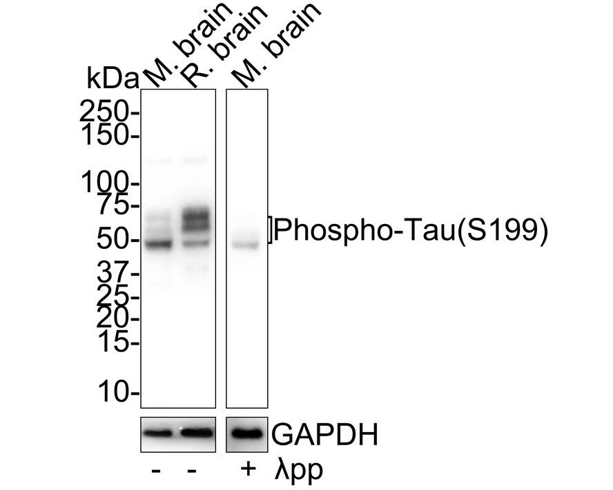 Western blot analysis on different lysates with NBP3-32802 at 1/2,000 dilution. Lane 1: Mouse brain tissue lysate Lane 2: Rat brain tissue lysate Lane 3: Mouse brain treated with  lambda pp for 1 hour tissue lysate Lysates/proteins at 30 µg/Lane. Predicted band size: 79 kDa Observed band size: 45-70 kDa Exposure time: 24 seconds; 4-20% SDS-PAGE gel. Proteins were transferred to a PVDF membrane and blocked with 5% NFDM/TBST for 1 hour at room temperature. NBP3-32802 at 1/2,000 dilution was used in 5% NFDM/TBST at 4℃ overnight. Goat Anti-Rabbit IgG [HRP] Secondary Antibody at 1/50,000 dilution was used for 1 hour at room temperature.