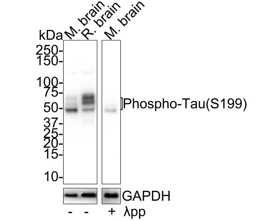 Western Blot: Tau [p Ser199] Antibody (JE66-80) [NBP3-32802] - Western blot analysis of Tau on different lysates with Rabbit anti-Tau antibody (NBP3-32802) at 1/2,000 dilution. Lane 1: Mouse brain tissue lysate Lane 2: Rat brain tissue lysate Lane 3: Mouse brain treated with  pp for 1 hour tissue lysate Lysates/proteins at 30 ug/Lane. Predicted band size: 79 kDa Observed band size: 45-70 kDa Exposure time: 24 seconds; 4-20% SDS-PAGE gel. Proteins were transferred to a PVDF membrane and blocked with 5% NFDM/TBST for 1 hour at room temperature. The primary antibody (NBP3-32802) at 1/2,000 dilution was used in 5% NFDM/TBST at 4C overnight. Goat Anti-Rabbit IgG - HRP Secondary Antibody at 1/50,000 dilution was used for 1 hour at room temperature.