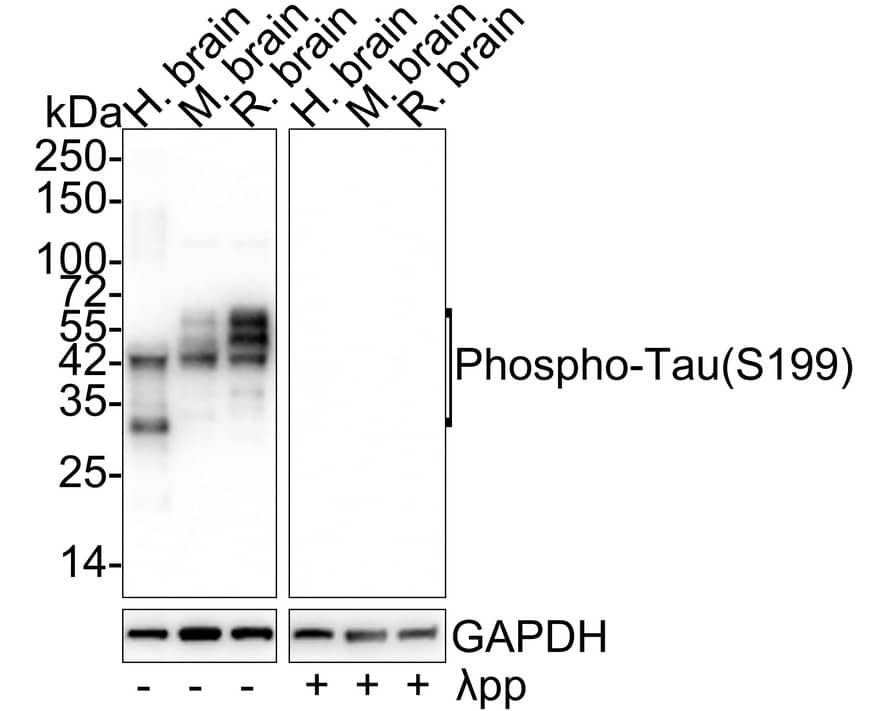 Western Blot: Tau [p Ser199] Antibody (JE46-95) [NBP3-32803] - Western blot analysis of Tau on different lysates with Rabbit anti-Tau antibody (NBP3-32803) at 1/1,000 dilution. Lane 1: Human brain tissue lysate Lane 2: Mouse brain tissue lysate Lane 3: Rat brain tissue lysate Lane 4: Human brain tissue lysate, the membrane treated with  pp for 1 hour Lane 5: Mouse brain tissue lysate, the membrane treated with  pp for 1 hour Lane 6: Rat brain tissue lysate, the membrane treated with  pp for 1 hour Lysates/proteins at 20 ug/Lane. Predicted band size: 79 kDa Observed band size: 35-70 kDa Exposure time: 3 seconds; 4-20% SDS-PAGE gel. Proteins were transferred to a PVDF membrane and blocked with 5% NFDM/TBST for 1 hour at room temperature. The primary antibody (NBP3-32803) at 1/1,000 dilution was used in 5% NFDM/TBST at 4C overnight. Goat Anti-Rabbit IgG - HRP Secondary Antibody at 1/50,000 dilution was used for 1 hour at room temperature.