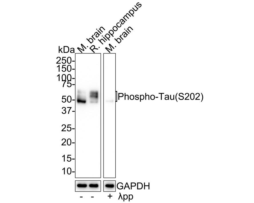 Western Blot: Tau [p Ser202] Antibody (JE66-81) [NBP3-32804] - Western blot analysis of Tau on different lysates with Rabbit anti-Tau antibody (NBP3-32804) at 1/2,000 dilution. Lane 1: Mouse brain tissue lysate Lane 2: Rat hippocampus tissue lysate Lane 3: Mouse brain treated with  pp for 1 hour tissue lysate Lysates/proteins at 30 ug/Lane. Predicted band size: 79 kDa Observed band size: 45-70 kDa Exposure time: 1 minute 2 seconds; 4-20% SDS-PAGE gel. Proteins were transferred to a PVDF membrane and blocked with 5% NFDM/TBST for 1 hour at room temperature. The primary antibody (NBP3-32804) at 1/2,000 dilution was used in 5% NFDM/TBST at 4C overnight. Goat Anti-Rabbit IgG - HRP Secondary Antibody at 1/50,000 dilution was used for 1 hour at room temperature.