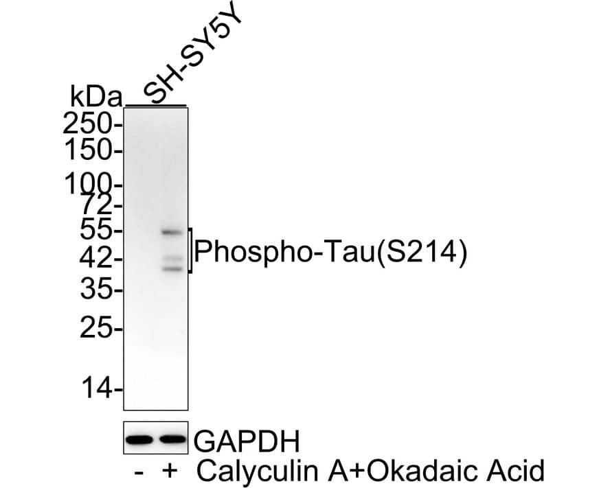 Western Blot: Tau [p Ser214] Antibody (JE66-83) [NBP3-32805] - Western blot analysis of Tau on different lysates with Rabbit anti-Tau antibody (NBP3-32805) at 1/1,000 dilution. Lane 1: SH-SY5Y cell lysate Lane 2: SH-SY5Y treated with 200nM Calyculin A and 1uM Okadaic Acid for 1 hour cell lysate Lysates/proteins at 20 ug/Lane. Predicted band size: 79 kDa Observed band size: 40-55 kDa Exposure time: 5 minutes; 4-20% SDS-PAGE gel. Proteins were transferred to a PVDF membrane and blocked with 5% NFDM/TBST for 1 hour at room temperature. The primary antibody (NBP3-32805) at 1/1,000 dilution was used in 5% NFDM/TBST at 4C overnight. Goat Anti-Rabbit IgG - HRP Secondary Antibody at 1/50,000 dilution was used for 1 hour at room temperature.