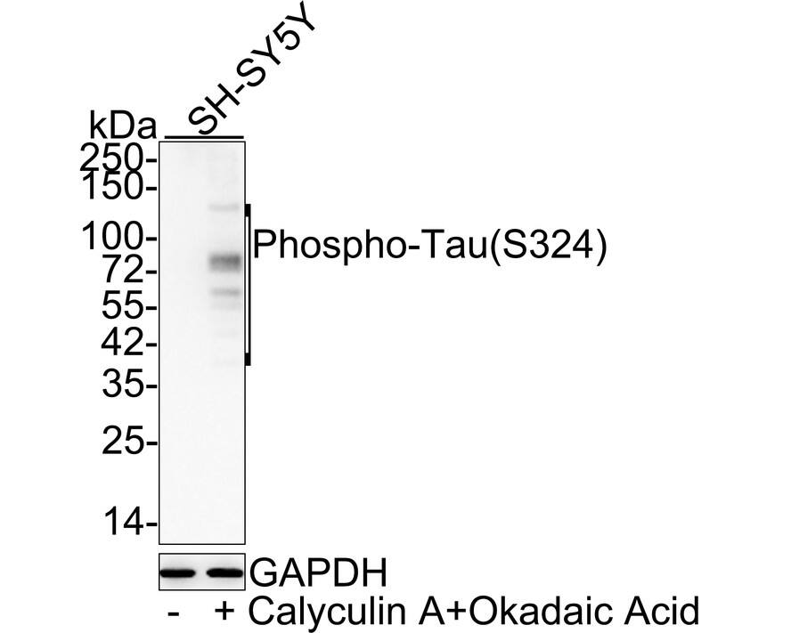 Western Blot: Tau [p Ser324] Antibody (JE30-73) [NBP3-32806] - Western blot analysis of Tau on different lysates with Rabbit anti-Tau antibody (NBP3-32806) at 1/1,000 dilution. Lane 1: SH-SY5Y cell lysate Lane 2: SH-SY5Y treated with 200nM Calyculin A and 1uM Okadaic Acid for 1 hour cell lysate Lysates/proteins at 20 ug/Lane. Predicted band size: 79 kDa Observed band size: 35-130 kDa Exposure time: 1 minute; 4-20% SDS-PAGE gel. Proteins were transferred to a PVDF membrane and blocked with 5% NFDM/TBST for 1 hour at room temperature. The primary antibody (NBP3-32806) at 1/1,000 dilution was used in 5% NFDM/TBST at 4C overnight. Goat Anti-Rabbit IgG - HRP Secondary Antibody at 1/50,000 dilution was used for 1 hour at room temperature.