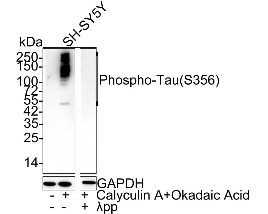 Western Blot: Tau [p Ser356] Antibody (JE46-86) [NBP3-32807] - Western blot analysis of Tau on different lysates with Rabbit anti-Tau antibody (NBP3-32807) at 1/1,000 dilution. Lane 1: SH-SY5Y cell lysate Lane 2: SH-SY5Y treated with 200nM Calyculin A and 1uM Okadaic Acid for 1 hour cell lysate Lane 3: SH-SY5Y treated with 200nM Calyculin A and 1uM Okadaic Acid for 1 hour, then treated with  pp for 1 hour cell lysate Lysates/proteins at 20 ug/Lane. Predicted band size: 79 kDa Observed band size: 50-250 kDa Exposure time: 3 minutes 19 seconds; 4-20% SDS-PAGE gel. Proteins were transferred to a PVDF membrane and blocked with 5% NFDM/TBST for 1 hour at room temperature. The primary antibody (NBP3-32807) at 1/1,000 dilution was used in 5% NFDM/TBST at 4C overnight. Goat Anti-Rabbit IgG - HRP Secondary Antibody at 1/50,000 dilution was used for 1 hour at room temperature.