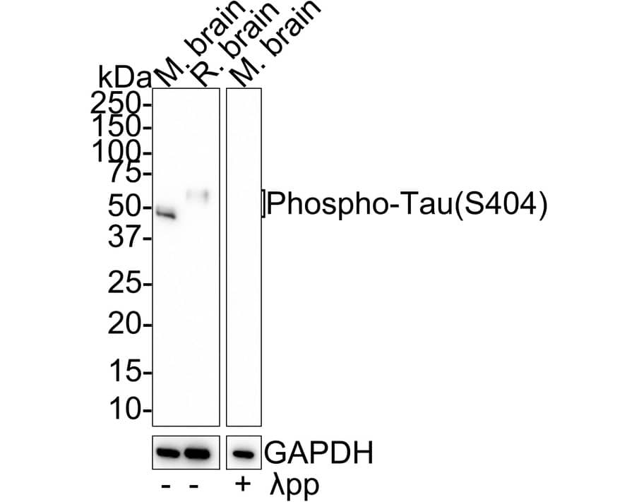 Western Blot: Tau [p Ser404] Antibody (JE66-82) [NBP3-32808] - Western blot analysis of Tau on different lysates with Rabbit anti-Tau antibody (NBP3-32808) at 1/2,000 dilution. Lane 1: Mouse brain tissue lysate Lane 2: Rat brain tissue lysate Lane 3: Mouse brain tissue lysate, the membrane treated with  pp for 1 hour  Lysates/proteins at 30 ug/Lane. Predicted band size: 79 kDa Observed band size: 45-70 kDa Exposure time: 3 minutes; 4-20% SDS-PAGE gel. Proteins were transferred to a PVDF membrane and blocked with 5% NFDM/TBST for 1 hour at room temperature. The primary antibody (NBP3-32808) at 1/2,000 dilution was used in 5% NFDM/TBST at 4C overnight. Goat Anti-Rabbit IgG - HRP Secondary Antibody at 1/50,000 dilution was used for 1 hour at room temperature.