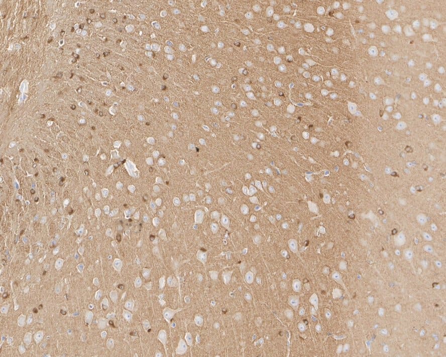 Immunohistochemistry: Tau [p Ser404] Antibody (JE66-82) [NBP3-32808] - Immunohistochemical analysis of paraffin-embedded mouse brain tissue with Rabbit anti-Tau antibody (NBP3-32808) at 1/1,000 dilution. The section was pre-treated using heat mediated antigen retrieval with Tris-EDTA buffer (pH 9.0) for 20 minutes. The tissues were blocked in 1% BSA for 20 minutes at room temperature, washed with ddH2O and PBS, and then probed with the primary antibody (NBP3-32808) at 1/1,000 dilution for 1 hour at room temperature. The detection was performed using an HRP conjugated compact polymer system. DAB was used as the chromogen. Tissues were counterstained with hematoxylin and mounted with DPX.