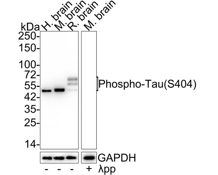 Western Blot: Tau [p Ser404] Antibody (JE47-88) [NBP3-32809] - Western blot analysis of Tau on different lysates with Rabbit anti-Tau antibody (NBP3-32809) at 1/1,000 dilution. Lane 1: Human brain tissue lysate Lane 2: Mouse brain tissue lysate Lane 3: Rat brain tissue lysate Lane 4: Mouse brain tissue lysate, the membrane treated with  pp for 1 hour Lysates/proteins at 30 ug/Lane. Predicted band size: 79 kDa Observed band size: 50-70 kDa Exposure time: 1 minute; 4-20% SDS-PAGE gel. Proteins were transferred to a PVDF membrane and blocked with 5% NFDM/TBST for 1 hour at room temperature. The primary antibody (NBP3-32809) at 1/1,000 dilution was used in 5% NFDM/TBST at 4C overnight. Goat Anti-Rabbit IgG - HRP Secondary Antibody at 1/50,000 dilution was used for 1 hour at room temperature.