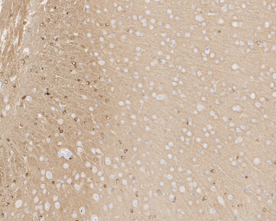 Immunohistochemistry: Tau [p Ser404] Antibody (JE47-88) [NBP3-32809] - Immunohistochemical analysis of paraffin-embedded mouse brain tissue with Rabbit anti-Tau antibody (NBP3-32809) at 1/1,000 dilution. The section was pre-treated using heat mediated antigen retrieval with Tris-EDTA buffer (pH 9.0) for 20 minutes. The tissues were blocked in 1% BSA for 20 minutes at room temperature, washed with ddH2O and PBS, and then probed with the primary antibody (NBP3-32809) at 1/1,000 dilution for 1 hour at room temperature. The detection was performed using an HRP conjugated compact polymer system. DAB was used as the chromogen. Tissues were counterstained with hematoxylin and mounted with DPX.