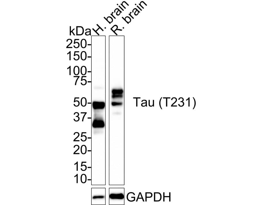 Western blot analysis on different lysates with NBP3-32810 at 1/1,000 dilution. Lane 1: Human brain tissue lysate Lane 2: Rat brain tissue lysate Lysates/proteins at 50 µg/Lane. Predicted band size: 46 kDa Observed band size: 35-70 kDa Exposure time: 2 minutes; 4-20% SDS-PAGE gel. Proteins were transferred to a PVDF membrane and blocked with 5% NFDM/TBST for 1 hour at room temperature. NBP3-32810 at 1/1,000 dilution was used in 5% NFDM/TBST at room temperature for 2 hours. Goat Anti-Rabbit IgG [HRP] Secondary Antibody at 1:100,000 dilution was used for 1 hour at room temperature.